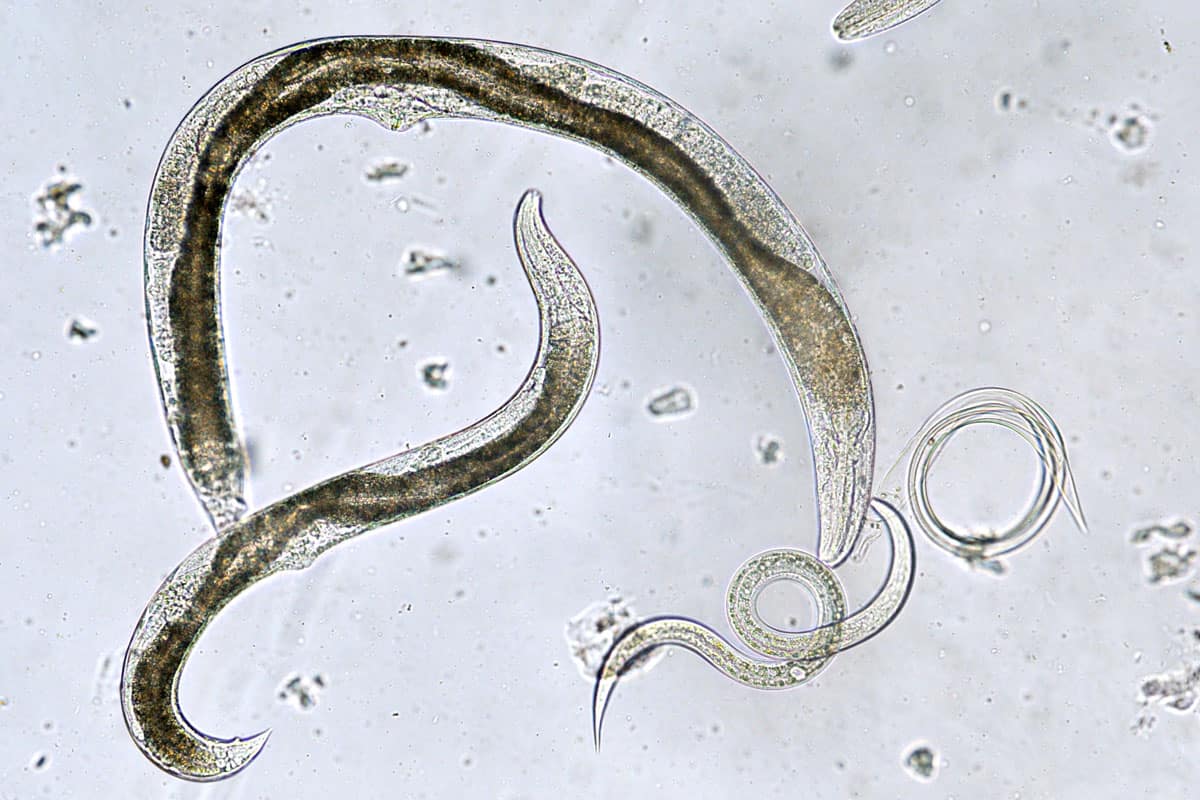 a close up photo of a parasite nematode, microscopic photo